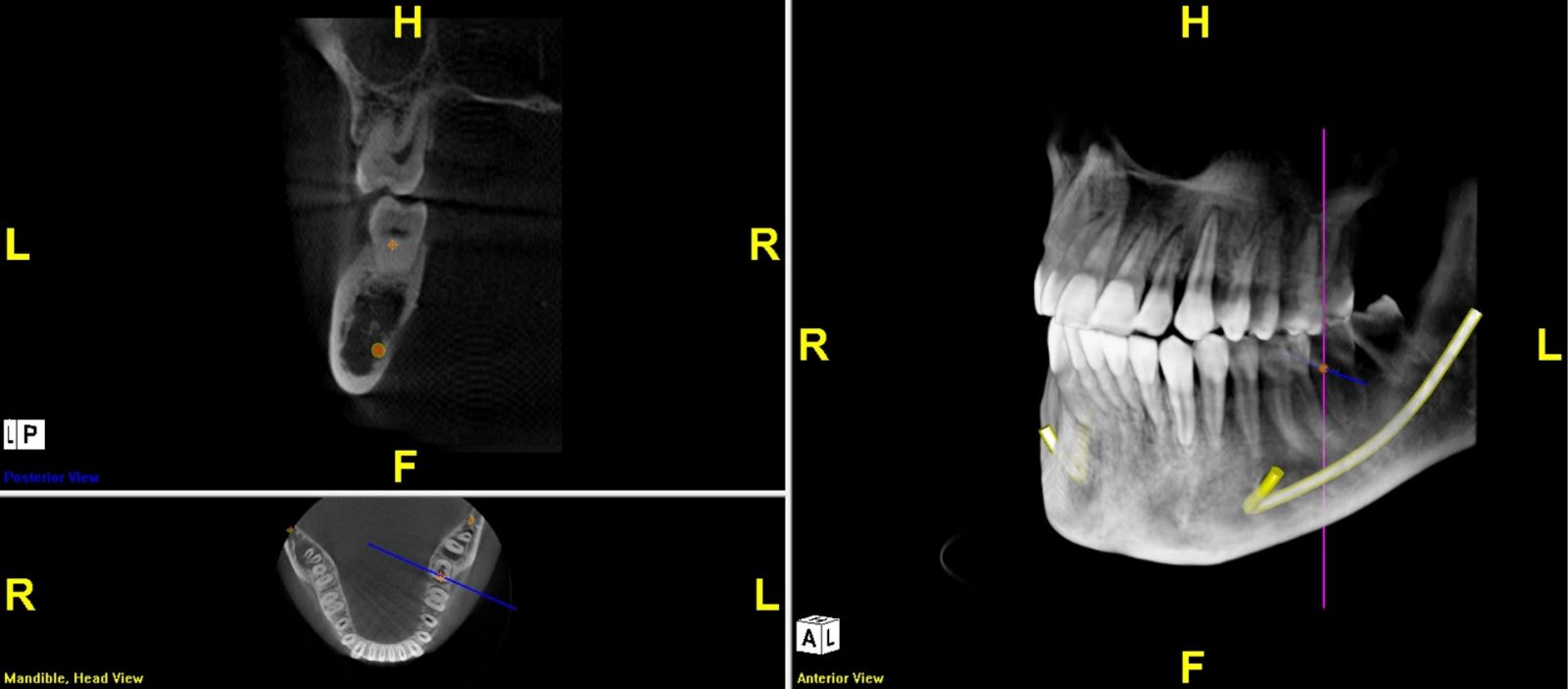 CONE BEAM CT